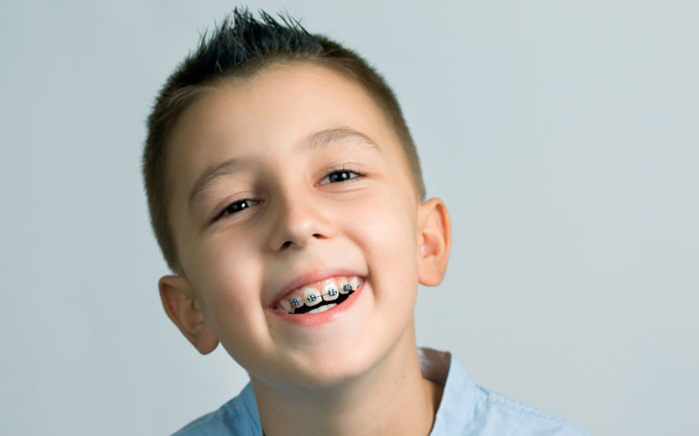 Cuento antes se inicie el tratamiento de ortodoncia, habrá más probabilidades de éxito
